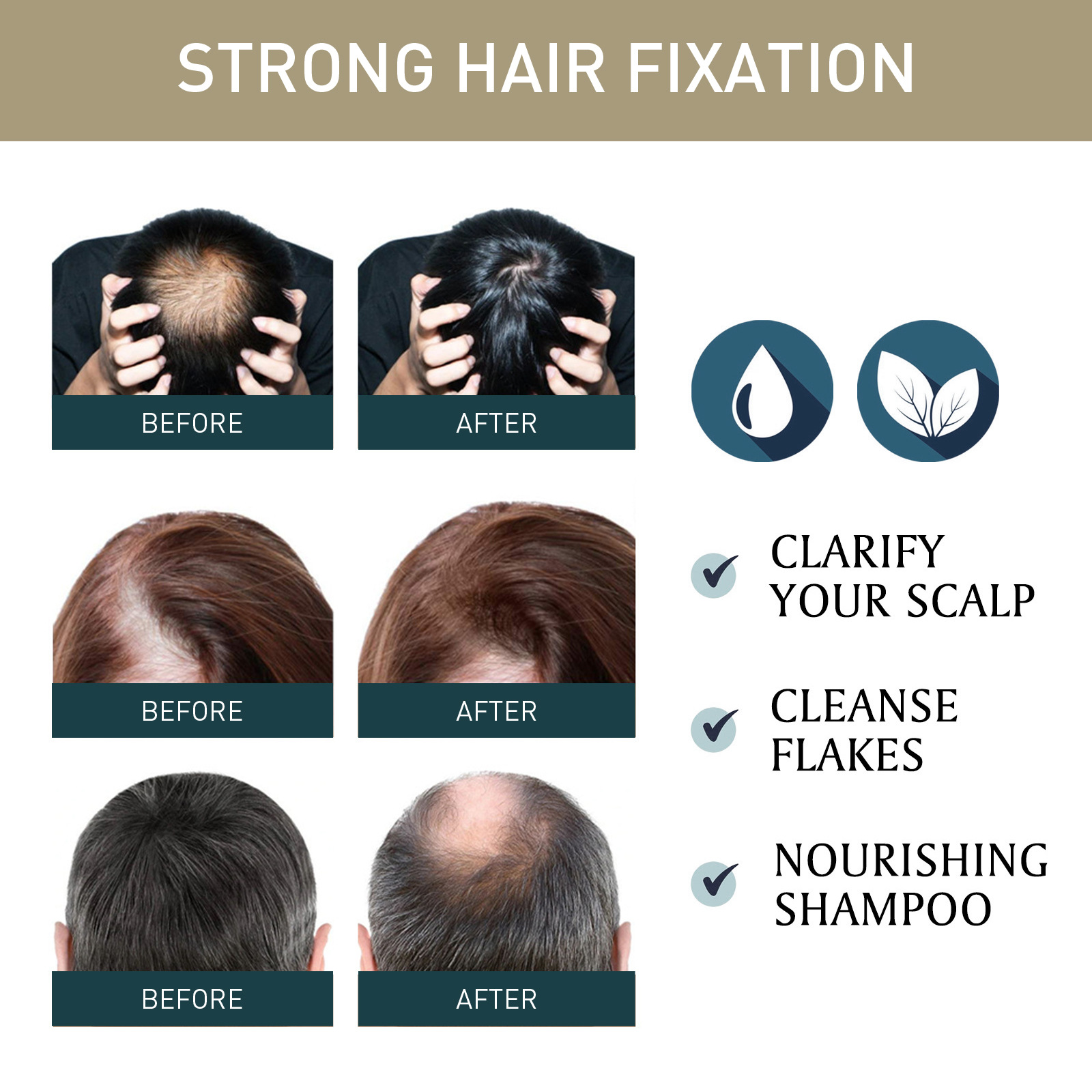 2pcsx100ml Hair Growth Shampoo - огляд і ціна Hair Care Natural Ingredients