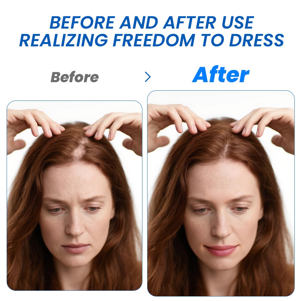 Alopecia Hair Growth Spray Sop - огляд і ціна Hair Care Cream